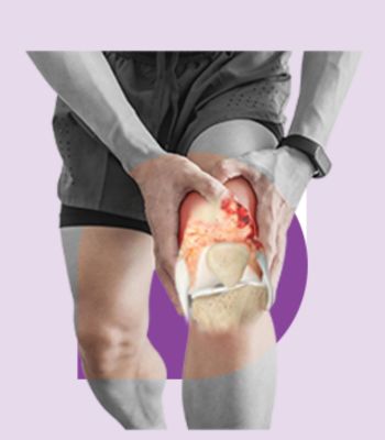 Bone and Soft Tissue Tumors