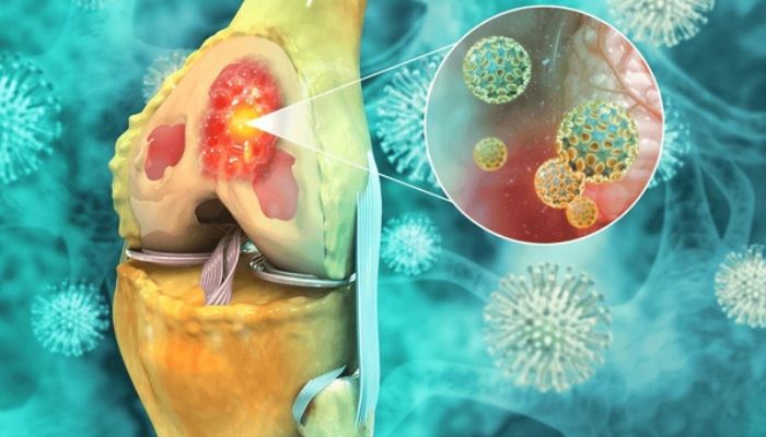 Bone and Soft Tissue Tumor Treatment